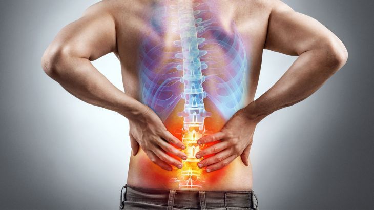 Ameliyatsız Bel Fıtığı Tedavisi