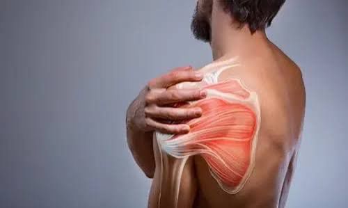 Donuk Omuz Tedavisi - Beylikdüzü Fizyoterapi