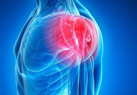 Omuz Ağrı Tedavisi - Beylikdüzü Fizyoterapi